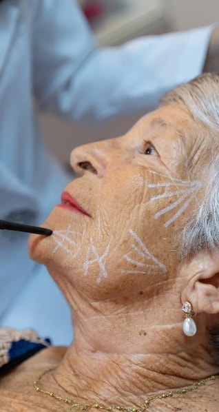 Lifting Facial (Ritidoplastia)